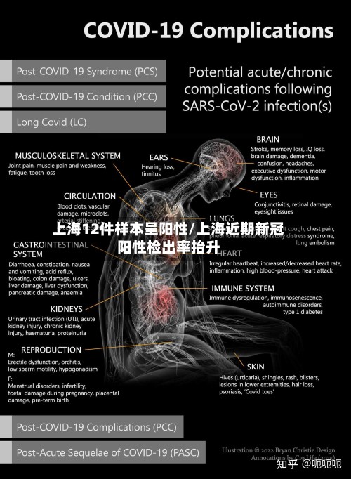 上海12件样本呈阳性/上海近期新冠阳性检出率抬升